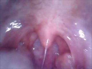 Klotter i mun vaginaen och röv